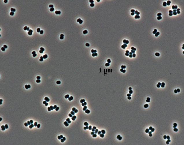 bacterial cells under microscope